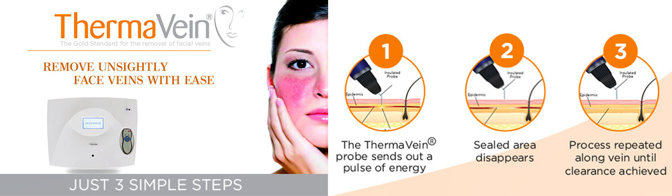 thermovain-banner thermovain