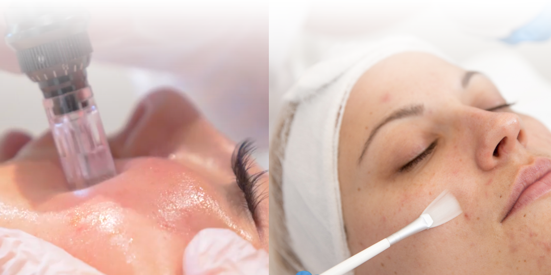 Microneedling + Chemical Peels (Instagram Post (Square)) (2)